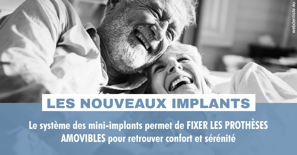 https://dr-labret-olivier.chirurgiens-dentistes.fr/Les nouveaux implants 2