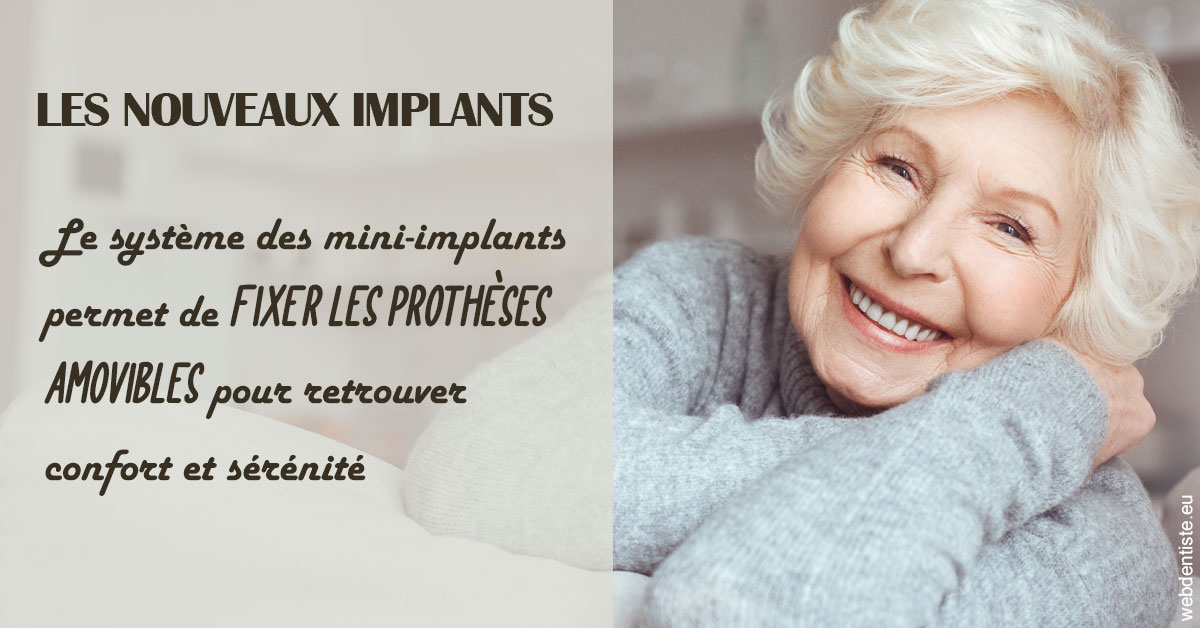 https://dr-labret-olivier.chirurgiens-dentistes.fr/Les nouveaux implants 1