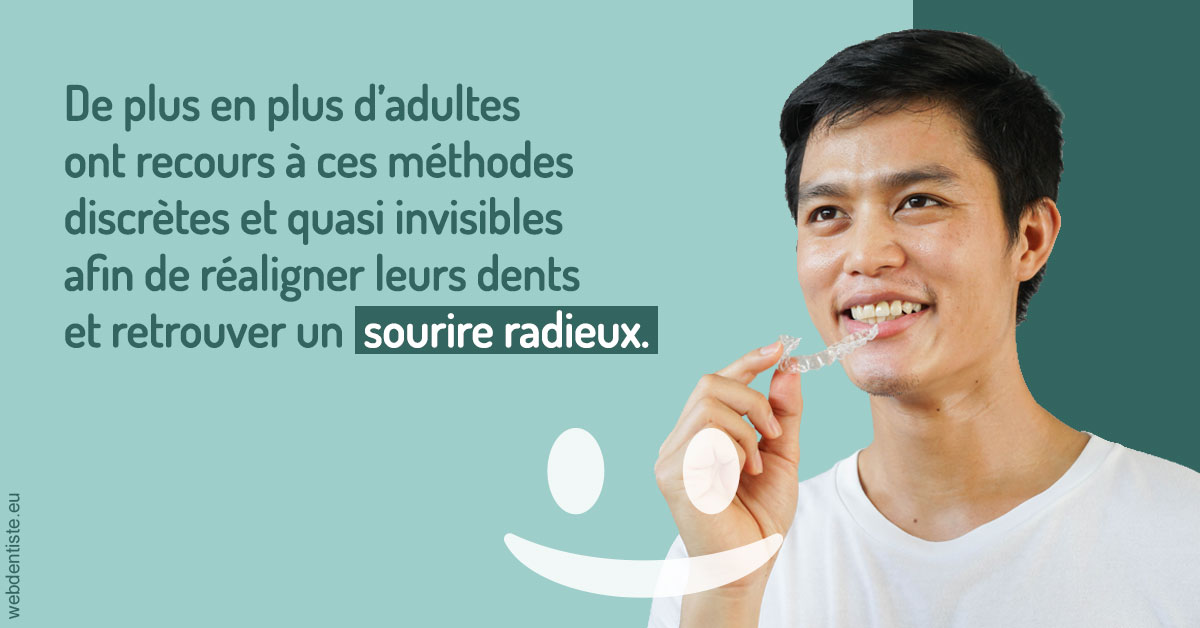 https://dr-labret-olivier.chirurgiens-dentistes.fr/Gouttières sourire radieux 2
