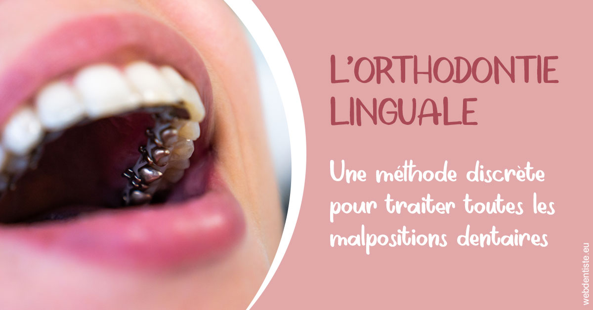 https://dr-labret-olivier.chirurgiens-dentistes.fr/L'orthodontie linguale 2