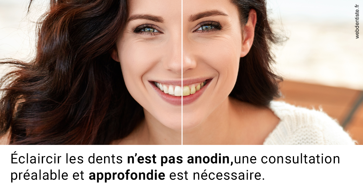 https://dr-labret-olivier.chirurgiens-dentistes.fr/Le blanchiment 2