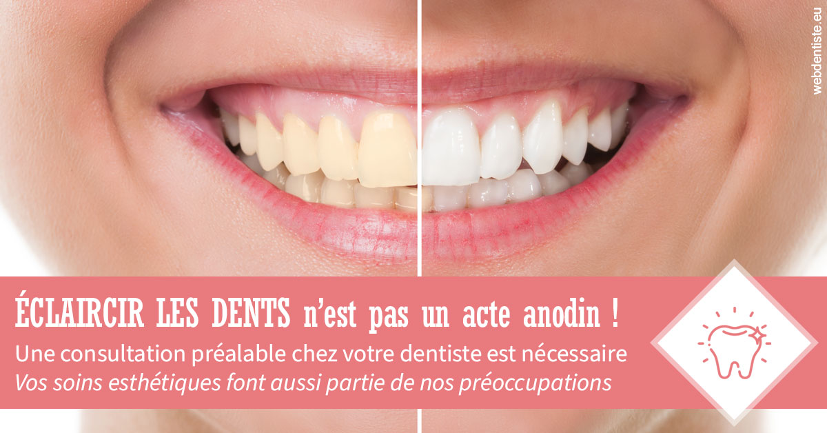 https://dr-labret-olivier.chirurgiens-dentistes.fr/Eclaircir les dents 1