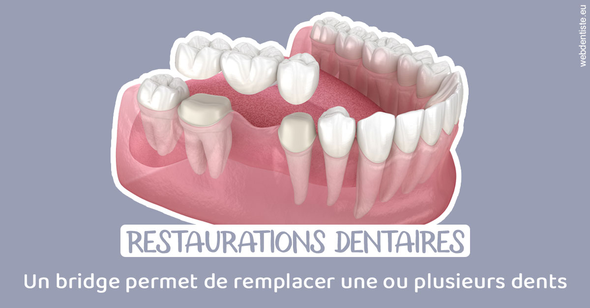 https://dr-labret-olivier.chirurgiens-dentistes.fr/Bridge remplacer dents 1