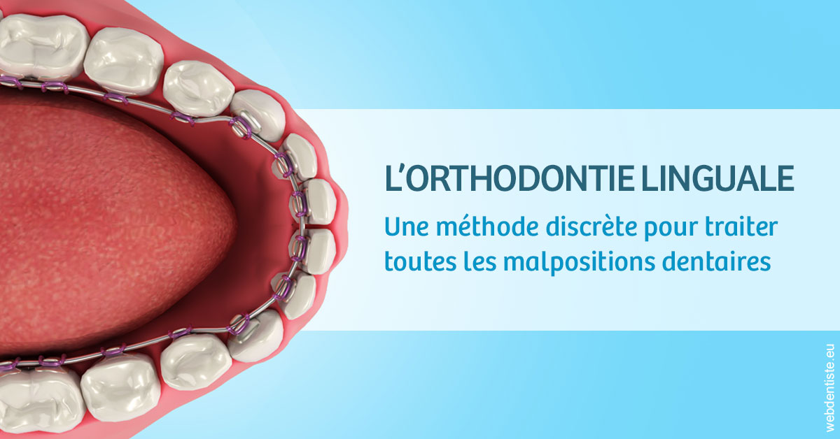 https://dr-labret-olivier.chirurgiens-dentistes.fr/L'orthodontie linguale 1