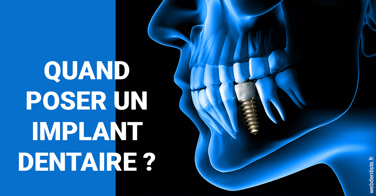 https://dr-labret-olivier.chirurgiens-dentistes.fr/Les implants 1