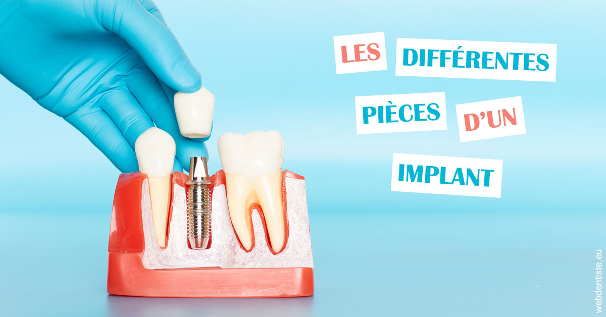 https://dr-labret-olivier.chirurgiens-dentistes.fr/Les différentes pièces d’un implant 2