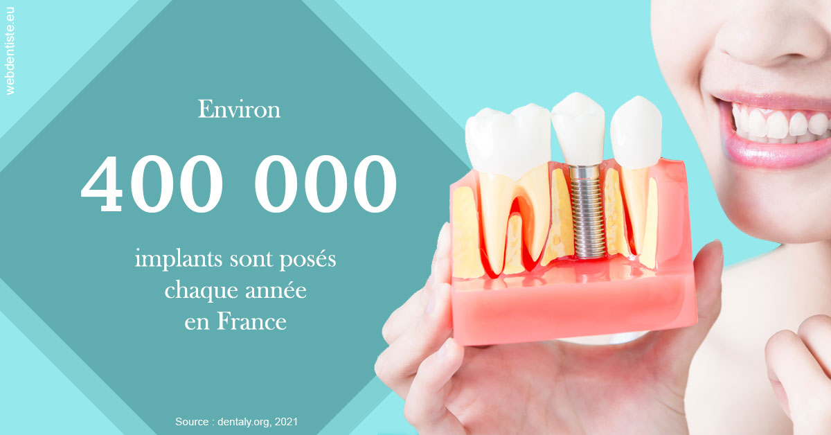 https://dr-labret-olivier.chirurgiens-dentistes.fr/Pose d'implants en France 2